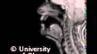 MRI voiced palatal approximant [upl. by Nomelihp85]