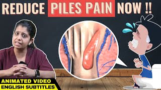 Animation Piles Pain Relief Hemorrhoids  மூல நோய் குணப்படுத்த எளிய வழிகள் [upl. by Marijo814]