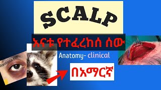 Scalp anatomy and clinical anatomy in amharic በአማርኛ [upl. by Noyr]