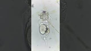 This rotifer has an egg inside it [upl. by Gati]