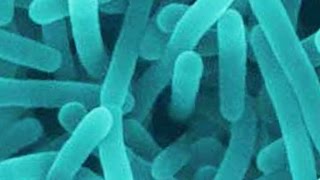 Update on foodborne listeria outbreaks [upl. by Asilam]