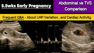 55wks Early Pregnancy  Abdominal vs TVS Ultrasound  Frequent QampA [upl. by Tabbitha]