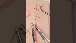 Winch Stitches surgery suturing funfacts stitches vet medicine surgeon surgeonlife suture [upl. by Marashio]