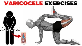 Pelvic Floor Exercises to Treat Varicocele [upl. by Ihsir]