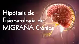 Hipótesis de Fisiopatología de Migraña Crónica  Neurociencia TV [upl. by Ahsekram]