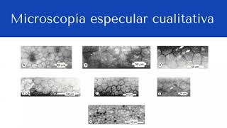 Microscopía Especular y Confocal  Dr Joaquín A Sosa Lockward [upl. by Eiboj]