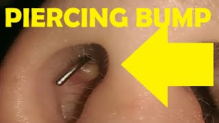 how to get rid of a piercing bump inside nose [upl. by Annehs]