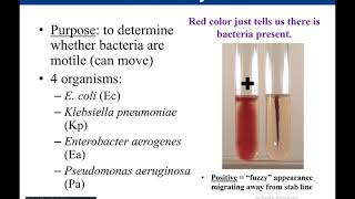 Lab 528 Motility Test [upl. by Bertasi]