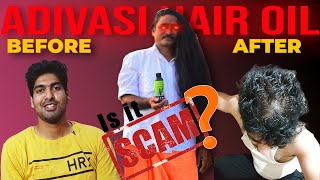 ADIVASI HAIR OIL SCAM  MY PERSONAL EXPERIENCE [upl. by Ibmat]