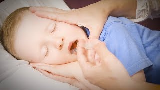 How to Give Your Child Buccal Midazolam [upl. by Adleremse]