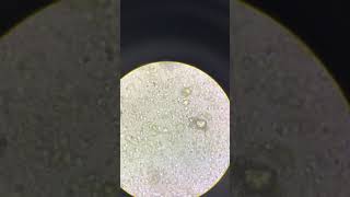 Giardia lamblia in stool sample [upl. by Glarum]