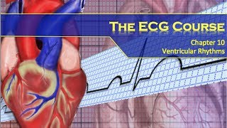 The ECG Course  Ventricular Rhythms [upl. by Meijer]