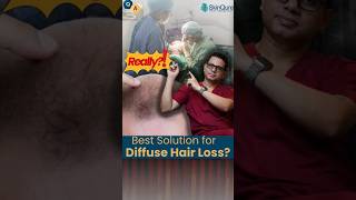 Is hair transplant possible in diffuse hair loss pattern  Dr Jangid Explains  shorts [upl. by Rennob]