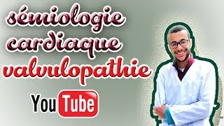 sémiologie cardiaque valvulopathie gauche [upl. by Tyoh]