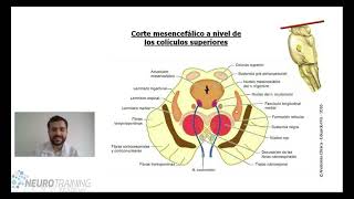 TALLO CEREBRAL ANATOMIA [upl. by Rosenkranz]