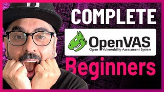 Complete Beginner OpenVAS Vulnerability Scanning Tutorial  Cyber Security  Kali Linux [upl. by Oetsira]