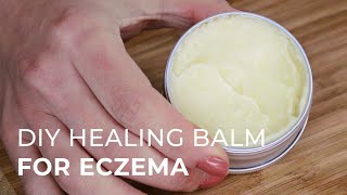 Tutorial for making a Natural Healing Cream for Eczema and Psoriasis [upl. by Yevre211]