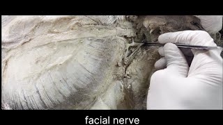 Facial nerve anatomy [upl. by Allimak477]