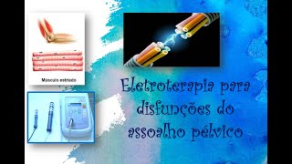 Eletroterapia para disfunções do assoalho pélvico  Dualpex uro 996 [upl. by Lundeen]