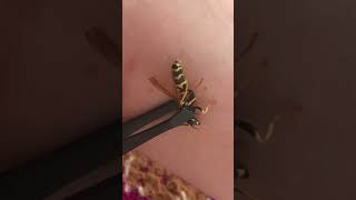 I Got Stung By A Paper Wasp [upl. by Oriole]