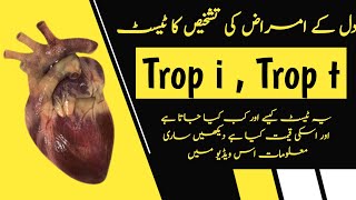 Troponin Enzymes Test in Urdu  Trop i Test  Best Test To Confirm Heart Attack [upl. by Corron]