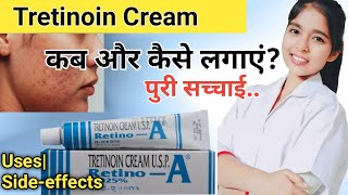 Retino a 0025 cream review  tretinoin Cream 0025 before and after  By Drx Pranjali Satpute [upl. by Adnaw]