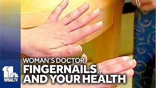 What fingernails can signal about your health [upl. by Kenti]