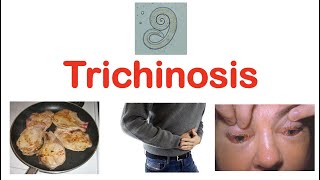 Trichinosis Pork Parasite  Pathophysiology Signs amp Symptoms Diagnosis Treatment [upl. by Airetak]