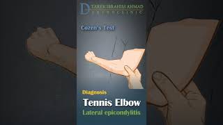 cozens test for tennis elbow  lateral epicondylitis [upl. by Arraic]