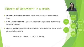 Lecture 3 Undescended testis Cryptorchidism by Dr Kanika Sharmam Pediatric Surgery IMS BHU [upl. by Adnerol]