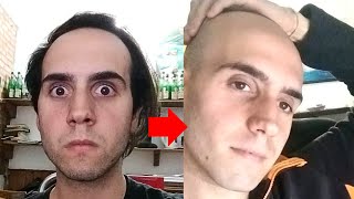 Balding Man More Attractive After Shaving Head Bald [upl. by Minier976]