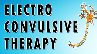 Electroconvulsive Therapy [upl. by Latton]