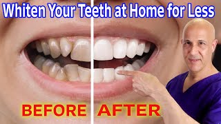 Whiten Your Teeth at Home for Nearly Free Dr Mandell [upl. by Aiveneg]