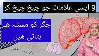 9 Signs Which Point Towards Liver Disease [upl. by Nahgem415]