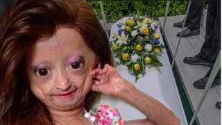 RIP Youtuber Adalia Rose Died Last Moment With her Mother😭This is so sd [upl. by Eidob]