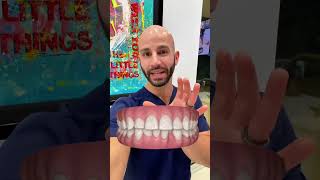 Why I DON’T want to extract this tooth doing Invisalign [upl. by Gazzo699]