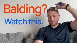 What to do if youre balding My hair loss protocol [upl. by Pepita]