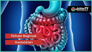 Crohn Hastalığı Nedir  İltihabi Bağırsak Hastalıkları  Ülseratif Kolit  Prof Dr Çetin Karaca [upl. by Utham453]