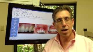 Wayne NJ Receding Gum Treatment  No Grafting or Stitches [upl. by Brine]