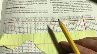 antibody identification demonstration [upl. by Yerrok]