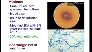 Subcutaneous Mycosis  mycetoma MICROBIOLOGY [upl. by Letitia769]