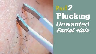 PART 2  Plucking Unwanted Facial Hair  Womens Beard Removal Tweezers  PCOS Warrior [upl. by Reimer]