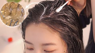 ASMR 시원한 두피 마사지스케일링빗질  Scalp Massage and Scalp Scaling [upl. by Niad]