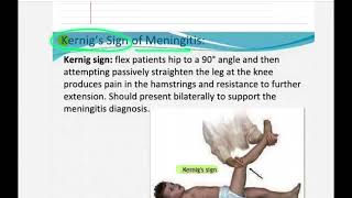 Meningitis positive sign 🛑 Kernigs sign amp Brudzinski sign in Nepali ✅ [upl. by Eaves407]