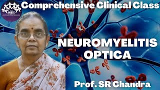 Neuromyelitis optica case presentation [upl. by Enaoj675]