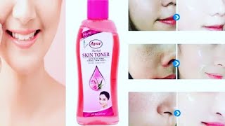 Ayur Herbal Skin toner review in Bangla Ayur toner for oily skin [upl. by Warfield]