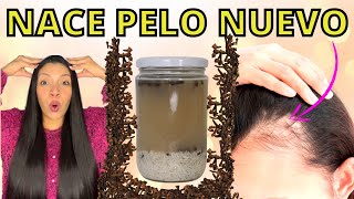 EL CABELLO CRECE COMO LOCO Y NO SE CAE😱 LA MEJOR RECETA DEL MUNDO PARA CRECER PELO😍FORMULA POTENTE [upl. by Prosperus]