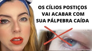 COMO CORRIGIR PTOSE SEM CIRURGIA😱ESSA DICA É INCRÍVELptosepalpebral cirurgiadaspalpebras [upl. by Nepsa]