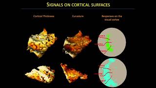 OHBM 2024  Educational Course  Deep Learning in Neuroimaging  Part 1 [upl. by Caputto]