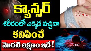 క్యాన్సర్ శరీరంలో ఎక్కడ వచ్చినా కనిపించే మొదటి లక్షణం ఇదేCancer Disease Symptoms In Telugu tumore [upl. by Narut269]